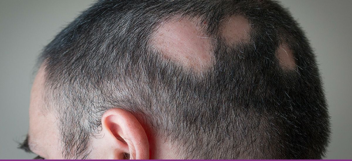 Dermatitis de Contacto