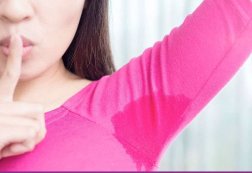 Hiperhidrosis