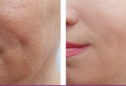 Maquillaje Correctivo