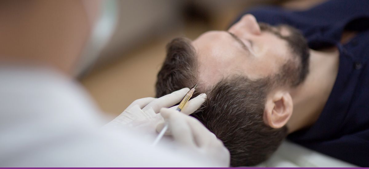 Mesoterapia Capilar