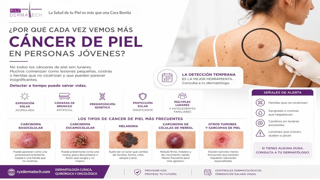 Cáncer de Piel en Jóvenes
